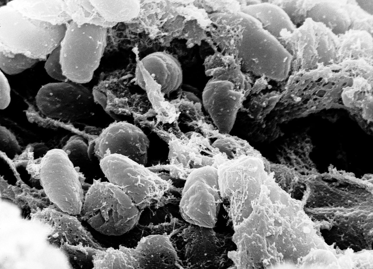 A greyscale scanning electron micrograph of dozens of plump rod shaped bacterial cells packed against one another inside a pitted mass of tissue, with fine fibrous strands webbed across them
