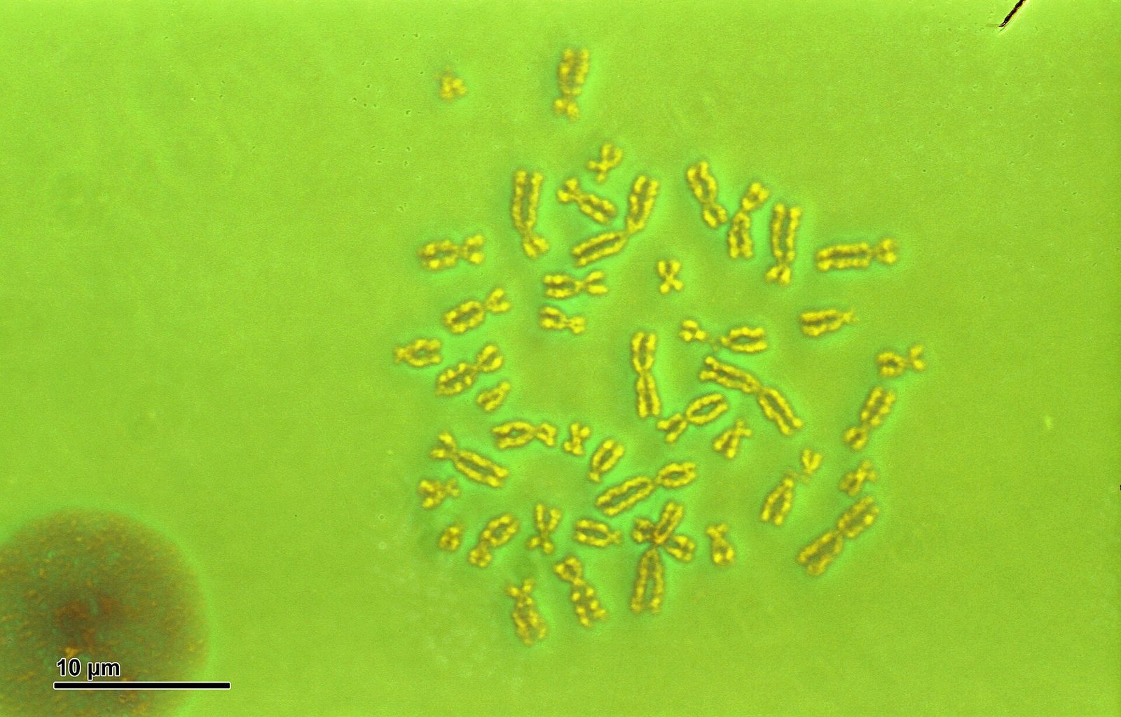 A microscope field filtered bright yellow-green. Several dozen small dark-gold chromosomes lie scattered across the centre and right of the frame in no particular order, most showing a paired-arm X or V shape, lying at every angle. A large out-of-focus dark disc sits at the lower left. A black scale bar labelled 10 micrometres runs along the bottom left corner.