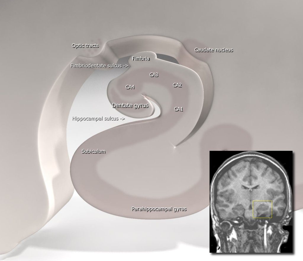 A stylised three-dimensional rendering in pale pink and grey of the hippocampus cut across, its inner layer curled into a spiral, with white text labels naming CA1, CA2, CA3, CA4, the dentate gyrus, the fimbria, the subiculum, the parahippocampal gyrus, the optic tracts, the caudate nucleus and two sulci, and a small greyscale MRI slice of a head inset at the lower right with a yellow box drawn on it