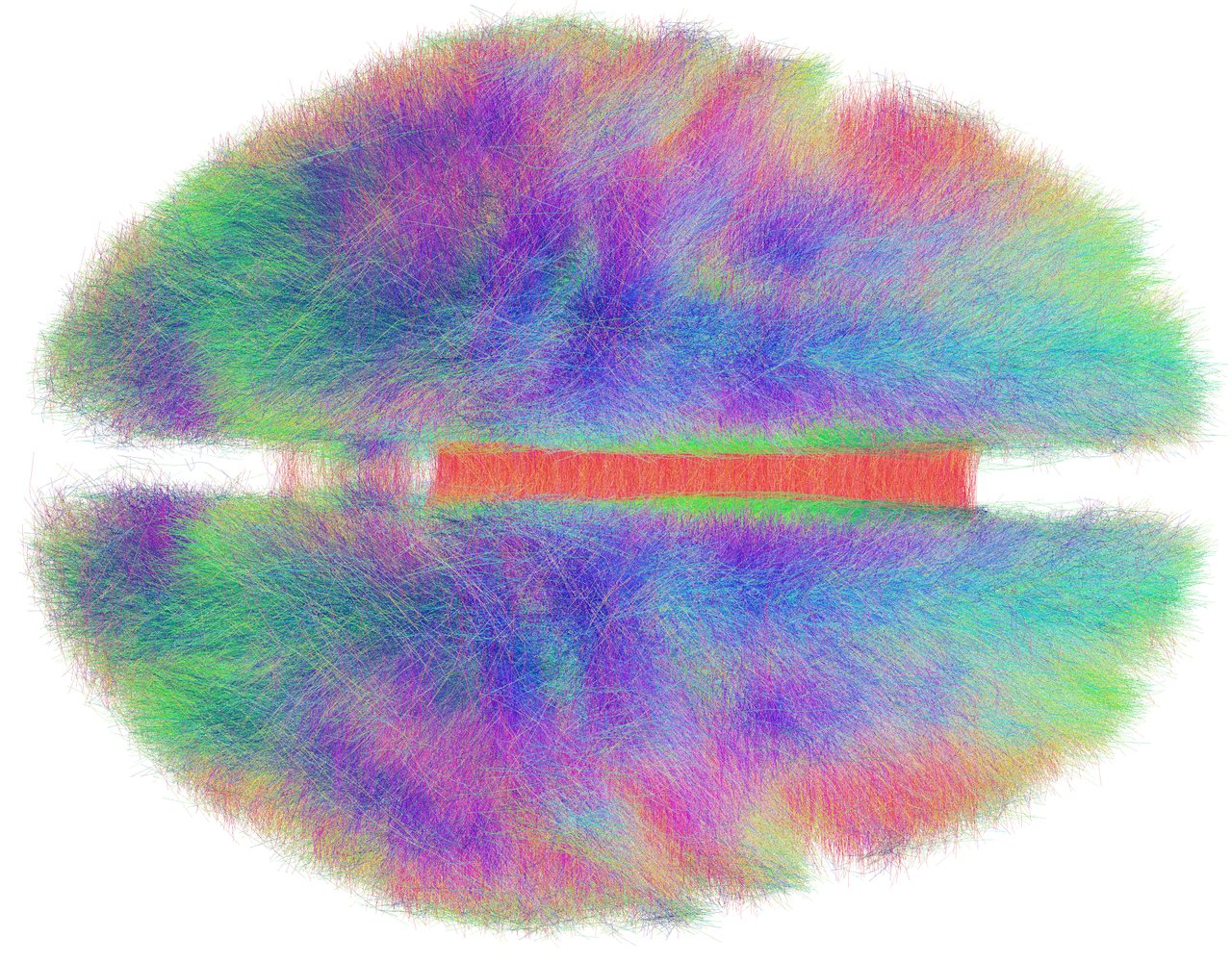 Brain white-matter tractography, two hemispheres rendered as dense masses of fine multicoloured fibres on white, with a broad red band of fibres bridging between them across the middle of the frame