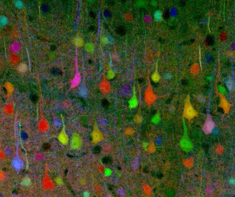 Mouse brain neurons individually labeled in many different fluorescent colors by the Brainbow technique, allowing single cells to be traced
