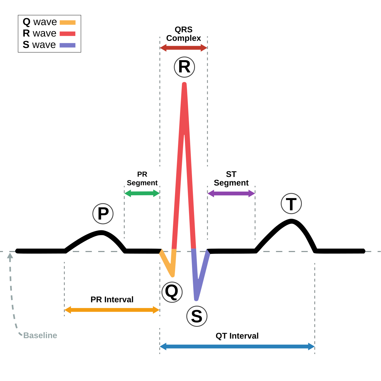 A labelled schematic of one heartbeat as an electrocardiogram draws it: a rounded P wave, a colour-coded QRS complex and a broad T wave along a dashed baseline, with coloured double-headed arrows marking the PR interval, PR segment, QRS complex, ST segment, and along the bottom in blue the QT interval