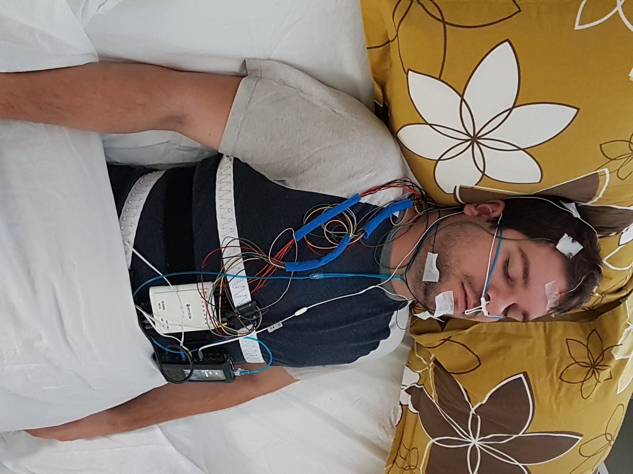 A person fitted with the full array of electrodes and sensors used in a clinical polysomnography sleep study