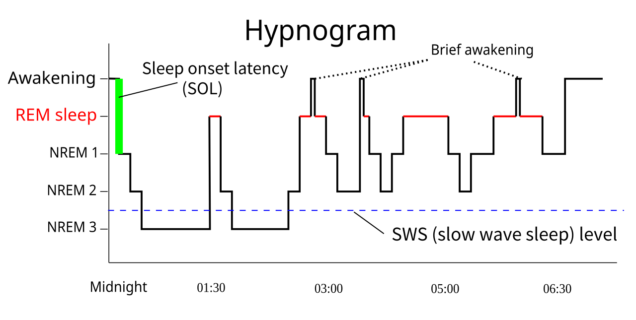 A labelled chart titled Hypnogram plotting sleep level against time from midnight to half past six, with horizontal steps at Awakening, REM sleep in red, NREM 1, NREM 2 and NREM 3, a green bar marking sleep onset latency, dotted arrows marking brief awakenings, and a blue dashed line marking slow wave sleep level