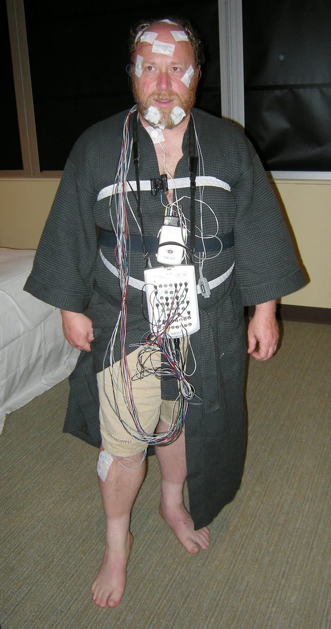 A bearded man standing barefoot in a hospital robe in a sleep laboratory, electrodes taped to his scalp, face and chin, a recording box strapped to his chest, a thick bundle of coloured wires hanging from it, and a further electrode taped to his shin