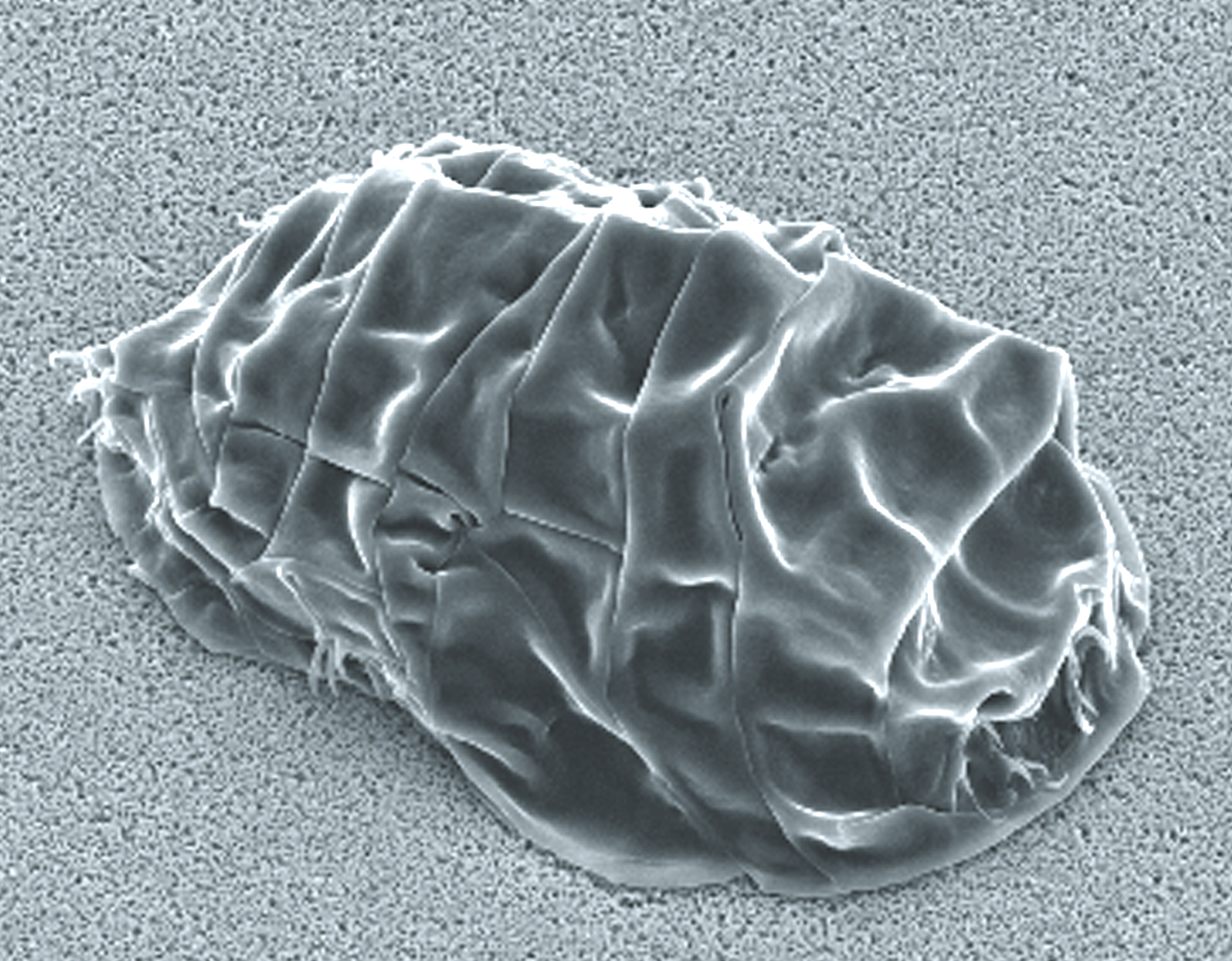 A scanning electron micrograph on a grainy grey ground. A shrunken oval body is creased into sharp deep folds like a collapsed bag, with the legs drawn almost entirely inside so that only small claw tips protrude around the rim. No head is distinguishable.