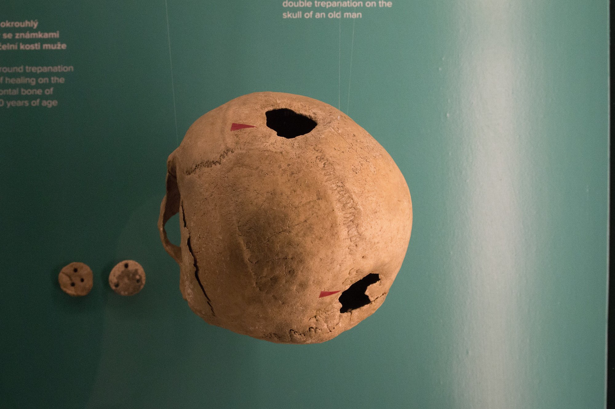 A tan-colored skull mounted in a museum case against a teal wall, with two dark trepanation openings marked by small red arrows, one on the top of the cranium and one lower down; nearby exhibit text reads 'double trepanation on the skull of an old man,' and two small round bone discs sit to the left