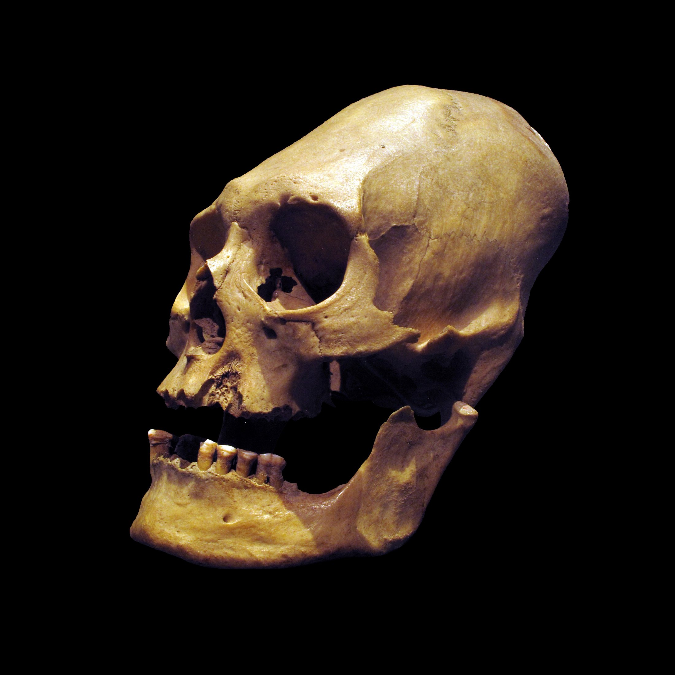 An ancient human skull in profile against a solid black background, warmly lit; the braincase is strikingly elongated and swept upward and back, and the jaw and several teeth are intact