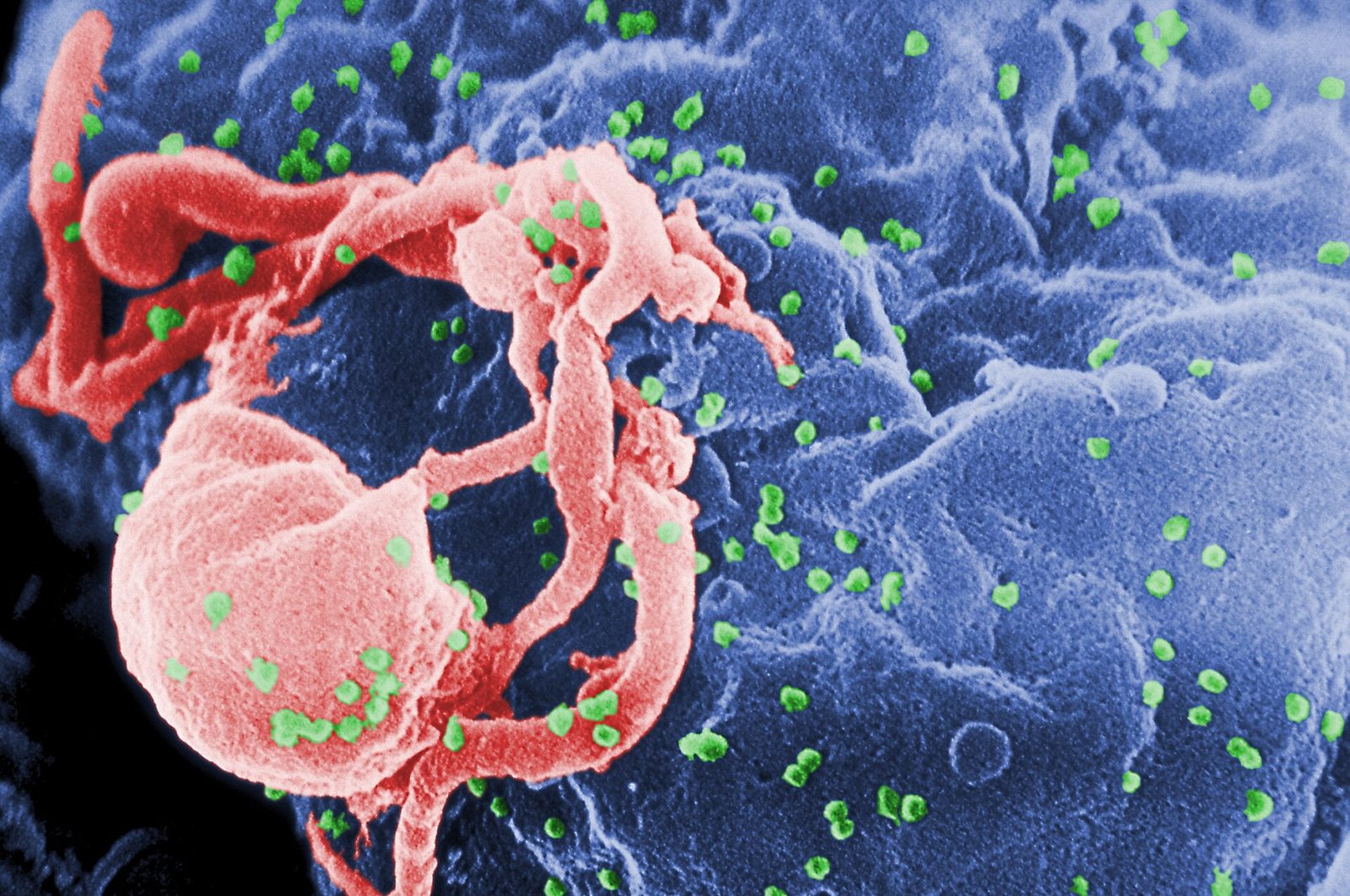 A colourised scanning electron micrograph. A blue cell surface fills the frame, ridged and folded, with salmon-pink membrane ruffles and a large rounded protrusion at the left. Several hundred small bright green spheres are scattered across the whole surface, densest around the pink structures.